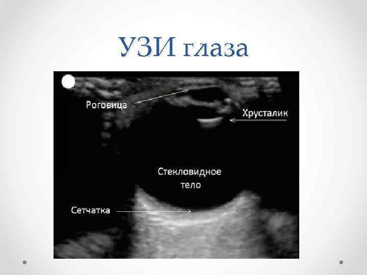 Узи глаза. УЗИ глазного яблока протокол. Глазное яблоко строение УЗИ. Ультразвуковая анатомия глаза.