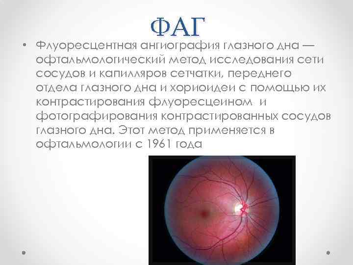 Современные методы исследования в офтальмологии презентация