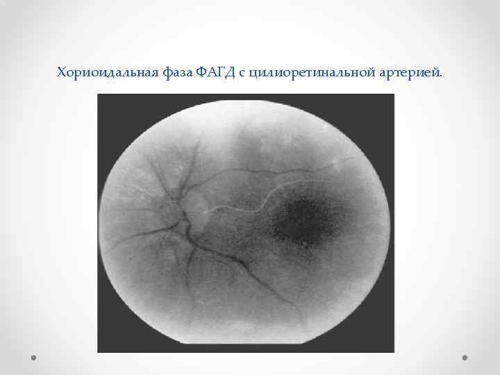 Методы исследования в офтальмологии презентация