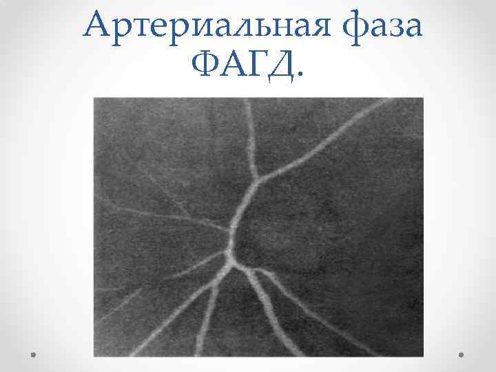  Артериальная фаза ФАГД. 