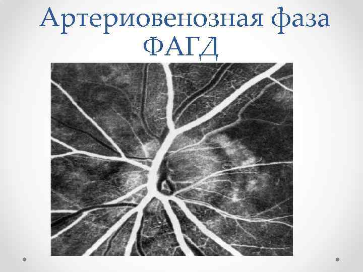  Артериовенозная фаза ФАГД 