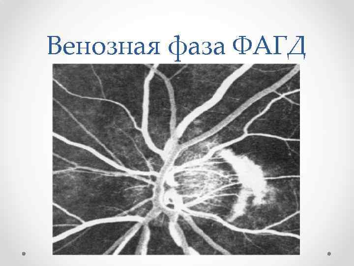 Венозная фаза ФАГД 