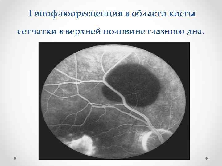 Современные методы исследования в офтальмологии презентация