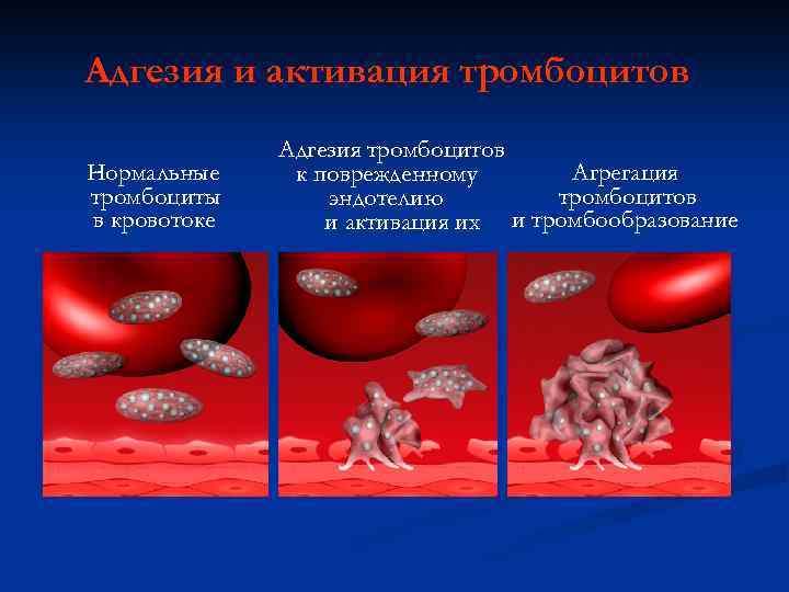 Адгезия и активация тромбоцитов Нормальные тромбоциты в кровотоке Адгезия тромбоцитов Агрегация к поврежденному тромбоцитов