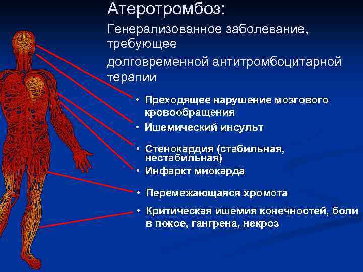 Атеротромбоз: Генерализованное заболевание, требующее долговременной антитромбоцитарной терапии • Преходящее нарушение мозгового кровообращения • Ишемический