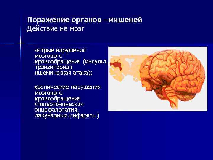 Поражение органов –мишеней Действие на мозг острые нарушения мозгового кровообращения (инсульт, транзиторная ишемическая атака);