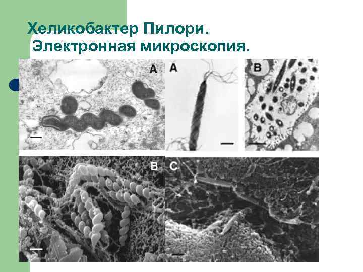 Хеликобактер Пилори. Электронная микроскопия. 