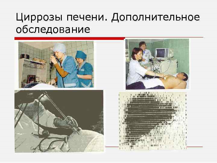 Циррозы печени. Дополнительное обследование 