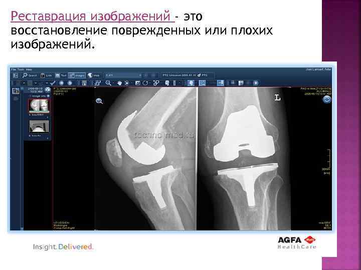 Реставрация изображений - это восстановление поврежденных или плохих изображений. 