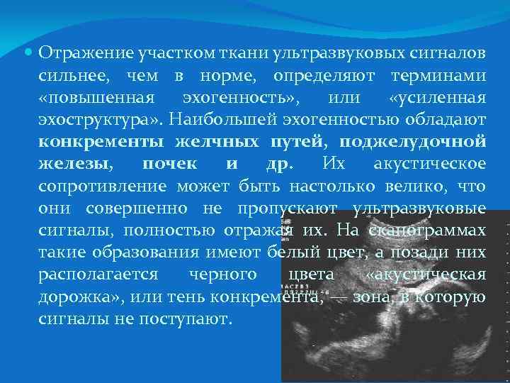  Отражение участком ткани ультразвуковых сигналов сильнее, чем в норме, определяют терминами «повышенная эхогенность»