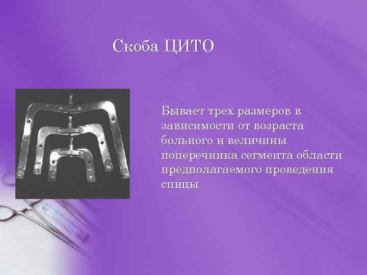 Скоба ЦИТО Бывает трех размеров в зависимости от возраста больного и величины поперечника сегмента