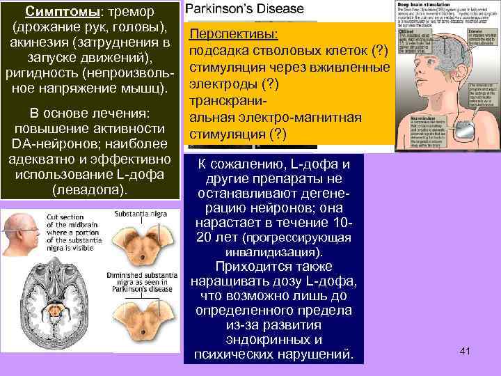 Симптомы: тремор (дрожание рук, головы), акинезия (затруднения в запуске движений), ригидность (непроизвольное напряжение мышц).