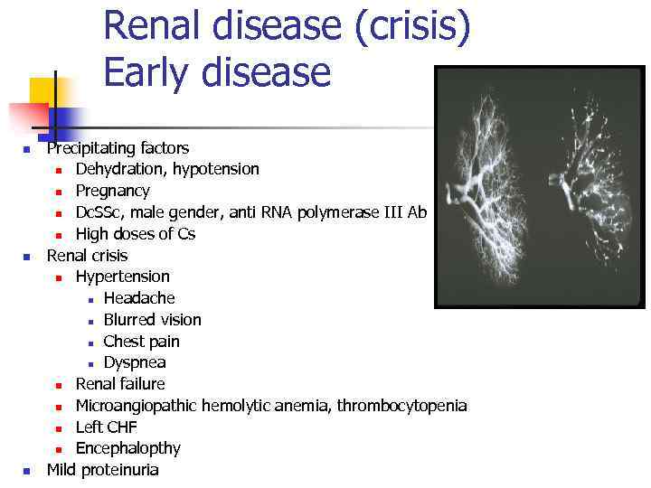 Renal disease (crisis) Early disease n n n Precipitating factors n Dehydration, hypotension n