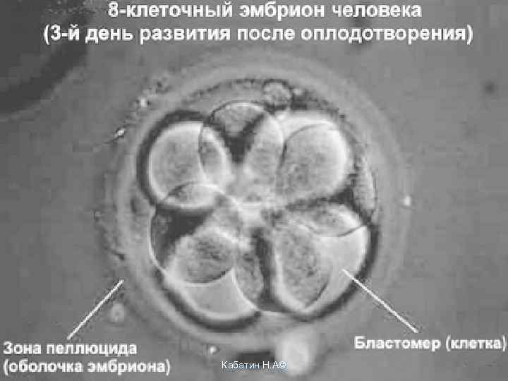 Подсадили эмбрион форум. 8 Клеточный эмбрион. 8 Клеточный эмбрион на 3 день. 5 День эмбриона после оплодотворения. Эко эмбрионы по дням.