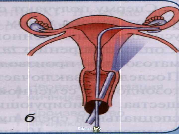 Кабатин Н. А© 