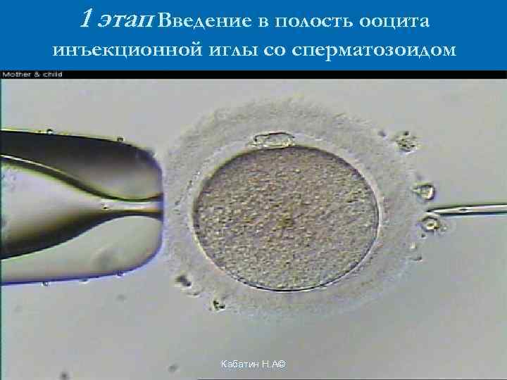 1 этап Введение в полость ооцита инъекционной иглы со сперматозоидом Кабатин Н. А© 