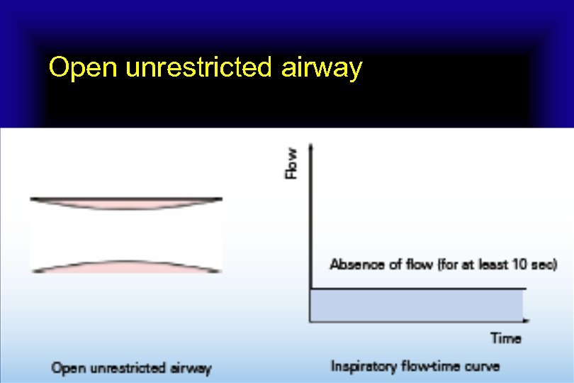 Open unrestricted airway 