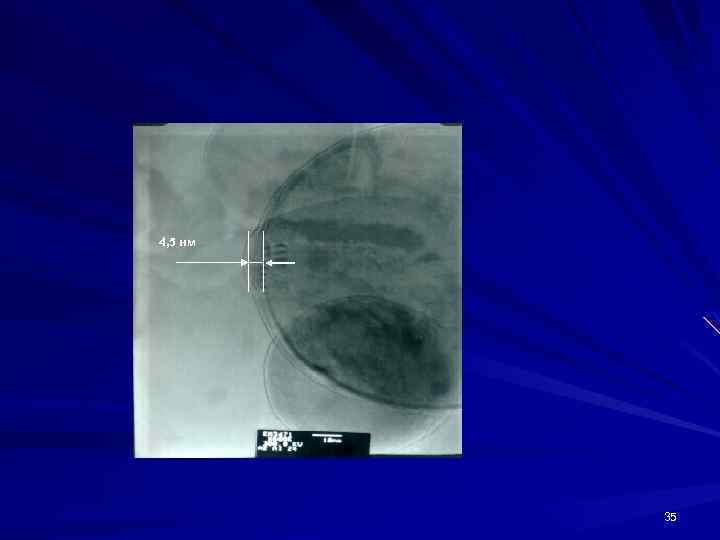  4, 5 нм 35 