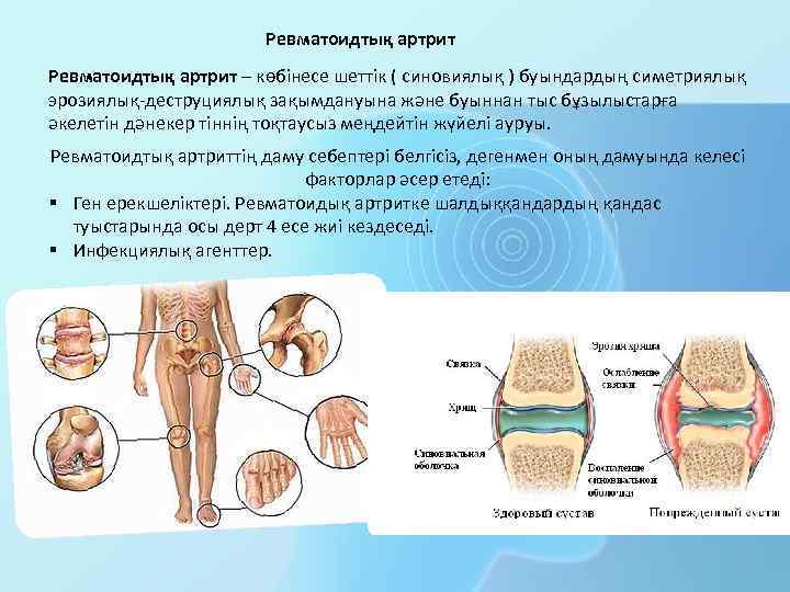 Тірек қимыл аппараты бұзылған балалар презентация