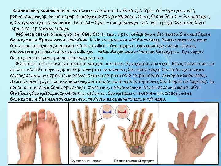 Артрит презентация қазақша