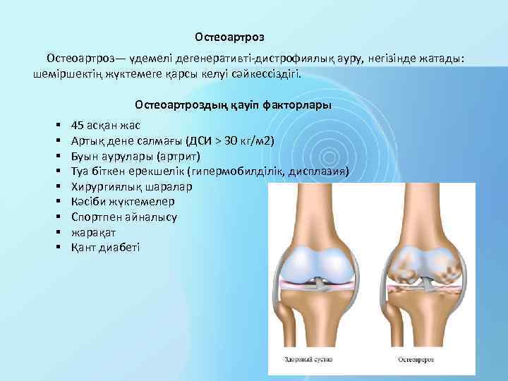 Остеоартроз— үдемелі дегенеративті-дистрофиялық ауру, негізінде жатады: шеміршектің жүктемеге қарсы келуі сәйкессіздігі. Остеоартроздың қауіп факторлары