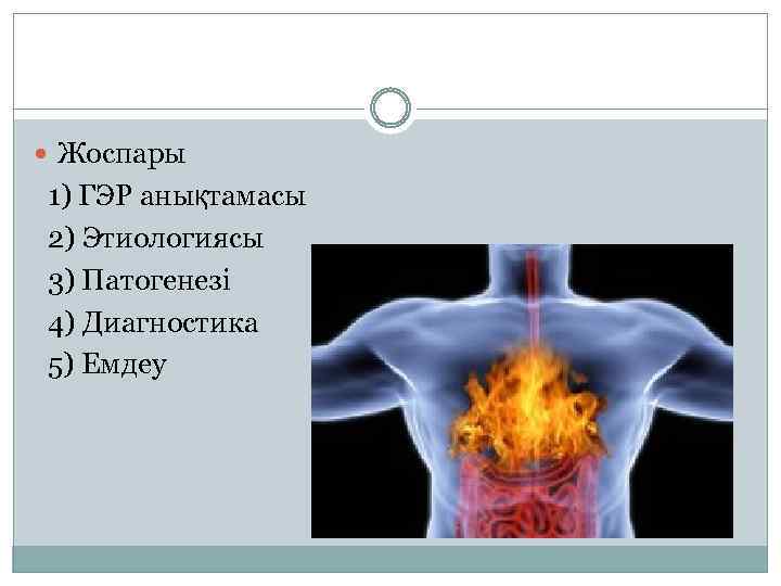  Жоспары 1) ГЭР анықтамасы 2) Этиологиясы 3) Патогенезі 4) Диагностика 5) Емдеу 
