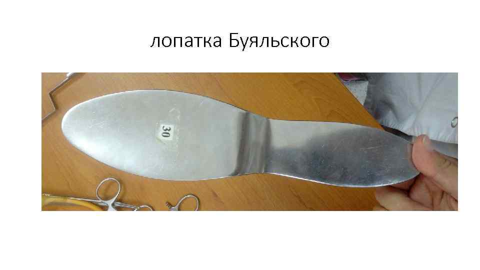 лопатка Буяльского 