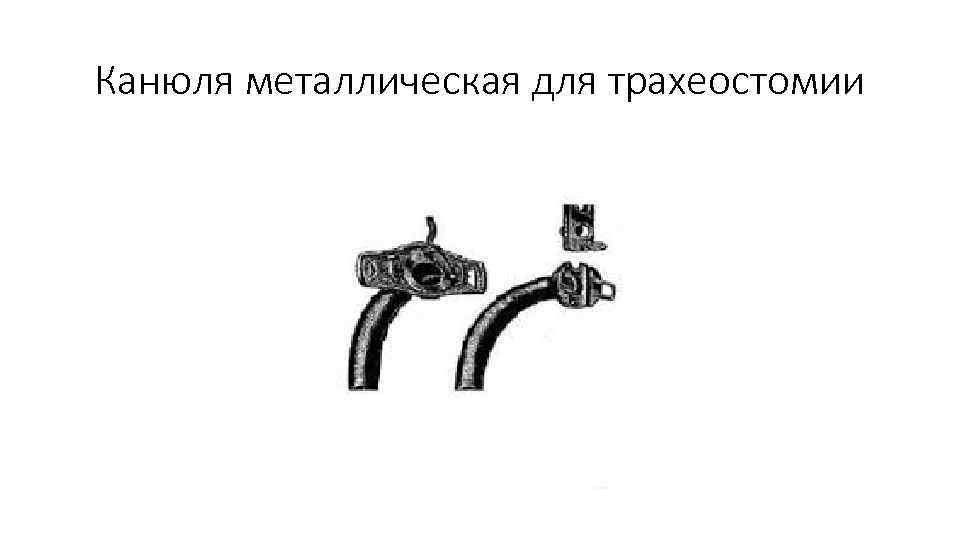 Канюля металлическая для трахеостомии 
