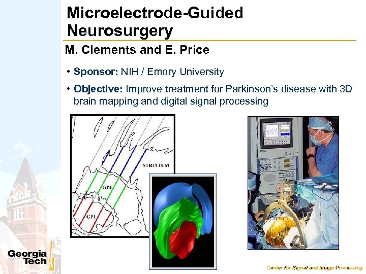 Microelectrode-Guided Neurosurgery M. Clements and E. Price • Sponsor: NIH / Emory University •