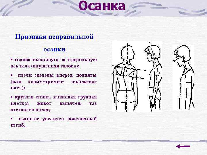 Осанка Признаки неправильной осанки • голова выдвинута за продольную ось тела (опущенная голова); •