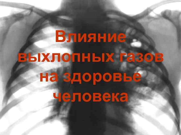 Влияние выхлопных газов на здоровье человека 