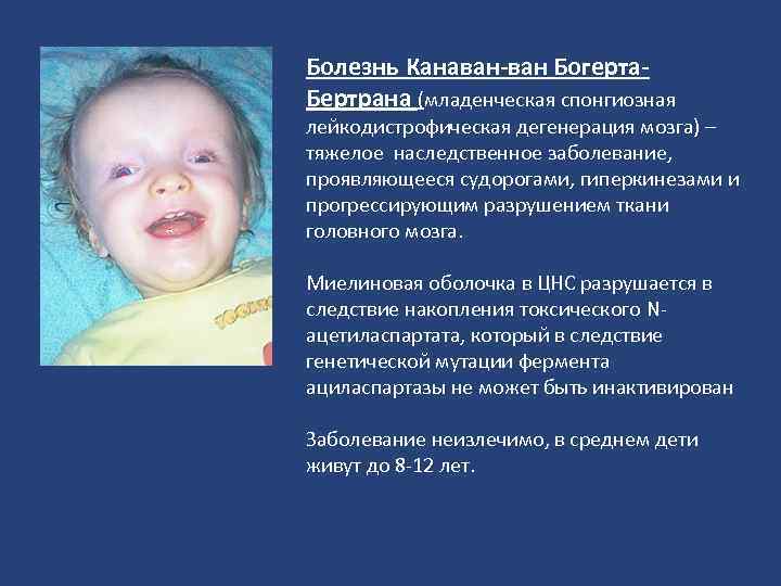 Болезнь Канаван-ван Богерта. Бертрана (младенческая спонгиозная лейкодистрофическая дегенерация мозга) – тяжелое наследственное заболевание, проявляющееся