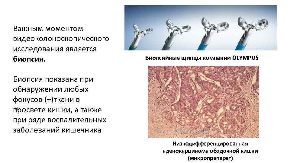 Биопсия 4 й категории