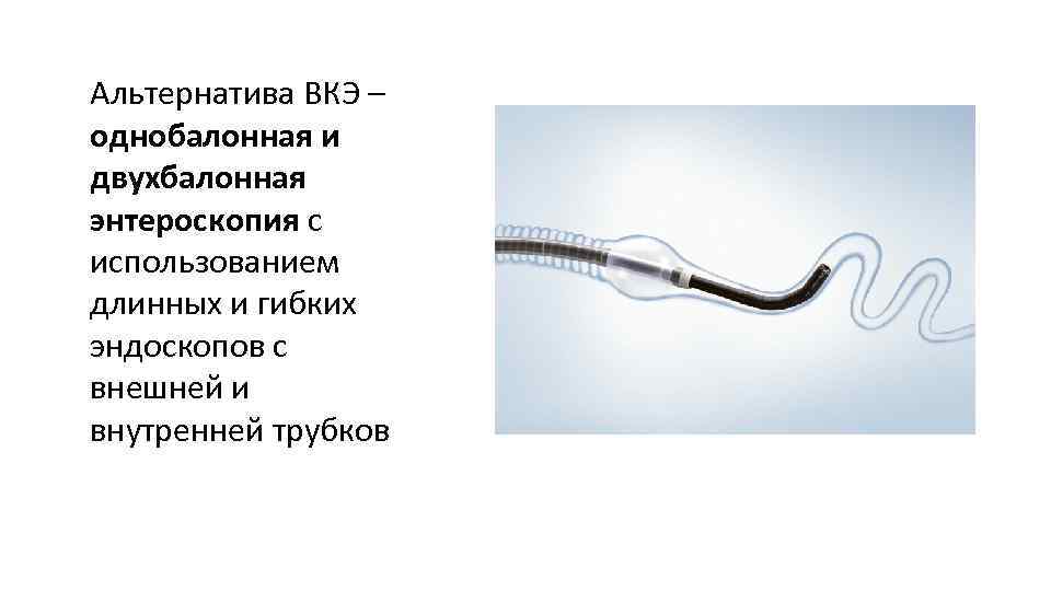 Альтернатива ВКЭ – однобалонная и двухбалонная энтероскопия с использованием длинных и гибких эндоскопов с
