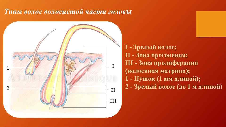 Типы волосистой части головы I - Зрелый волос; II - Зона ороговения; III -