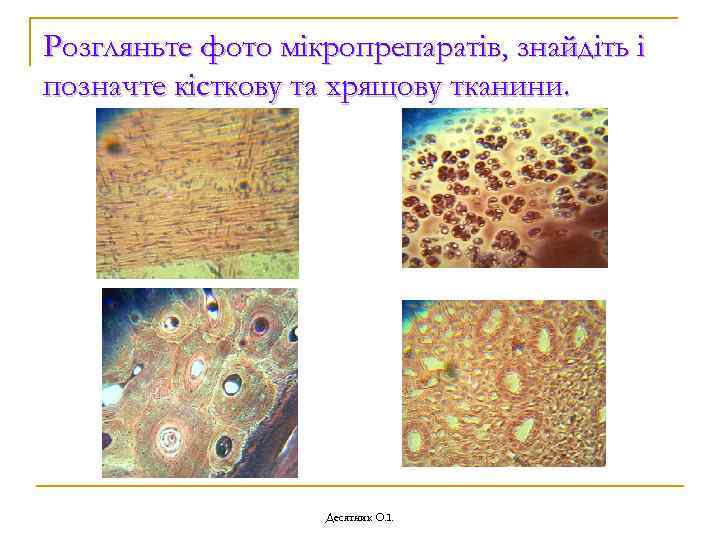 Розгляньте фото мікропрепаратів, знайдіть і позначте кісткову та хрящову тканини. Десятник О. І. 