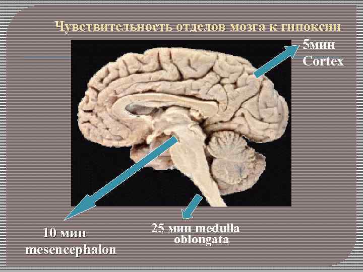 Чувствительность отделов мозга к гипоксии 5 мин Cortex 10 мин mesencephalon 25 мин medulla