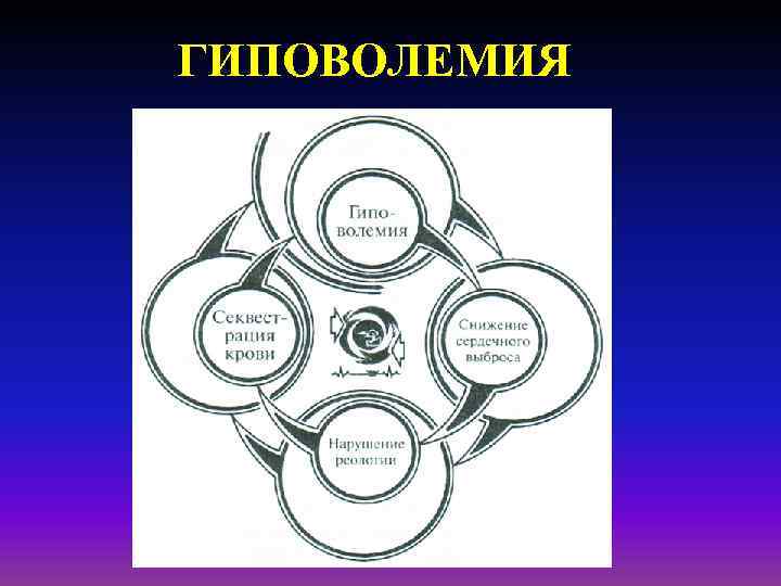 ГИПОВОЛЕМИЯ 