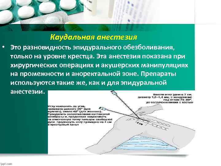 Каудальная анестезия • Это разновидность эпидурального обезболивания, только на уровне крестца. Эта анестезия показана