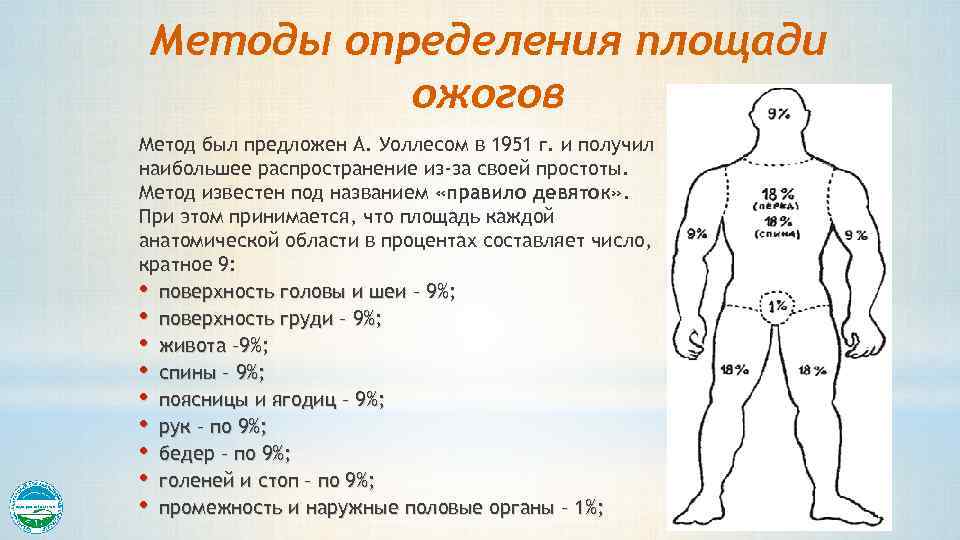 Методы определения площади ожогов Метод был предложен А. Уоллесом в 1951 г. и получил