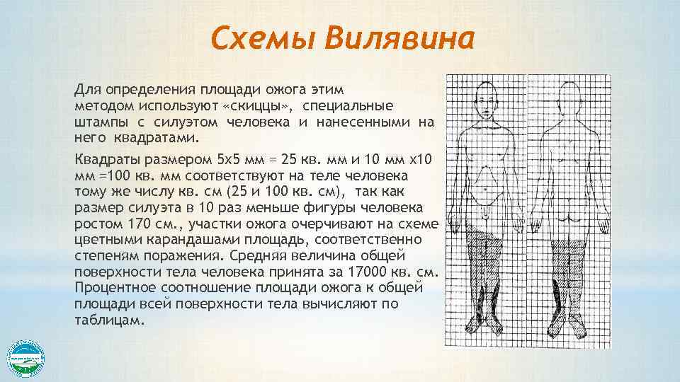 Схемы Вилявина Для определения площади ожога этим методом используют «скиццы» , специальные штампы с