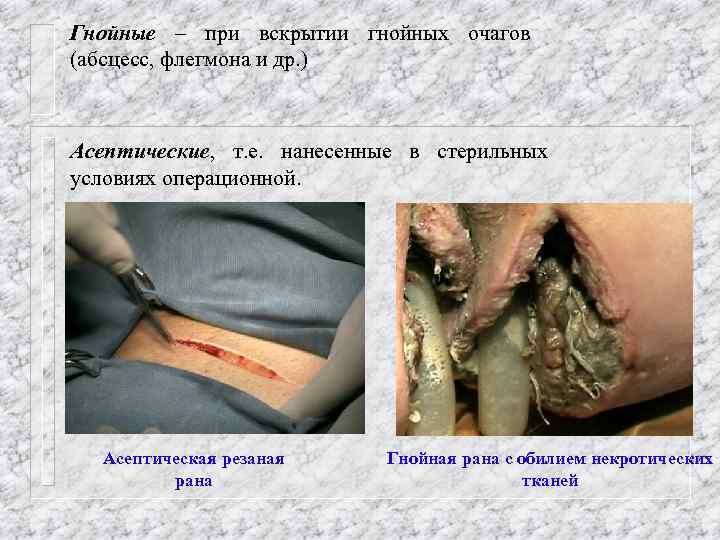 Гнойные – при вскрытии гнойных очагов (абсцесс, флегмона и др. ) Асептические, т. е.