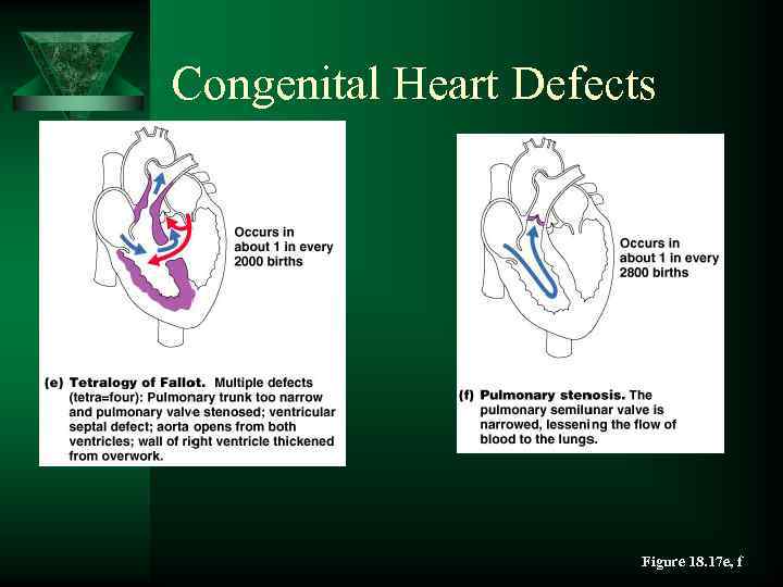 Congenital Heart Defects Figure 18. 17 e, f 
