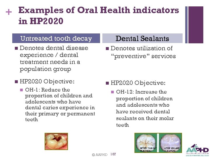 + Examples of Oral Health indicators in HP 2020 Dental Sealants Untreated tooth decay