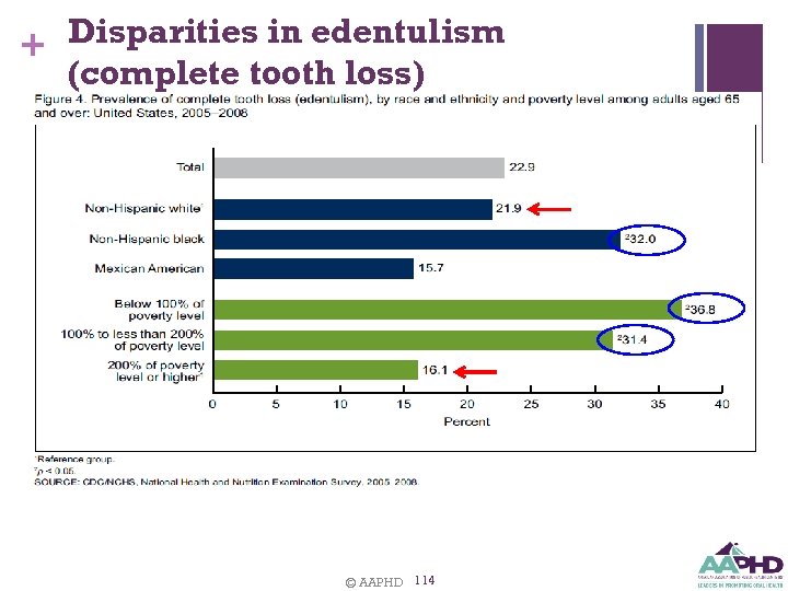 Disparities in edentulism + (complete tooth loss) © AAPHD 114 