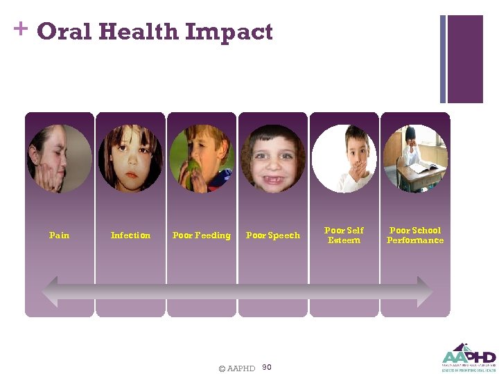 + Oral Health Impact Pain Infection Poor Feeding Poor Speech © AAPHD 90 Poor