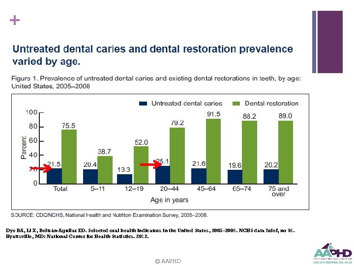 + Dye BA, Li X, Beltrán-Aguilar ED. Selected oral health indicators in the United