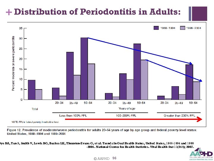 + Distribution of Periodontitis in Adults: Dye BA, Tan S, Smith V, Lewis BG,