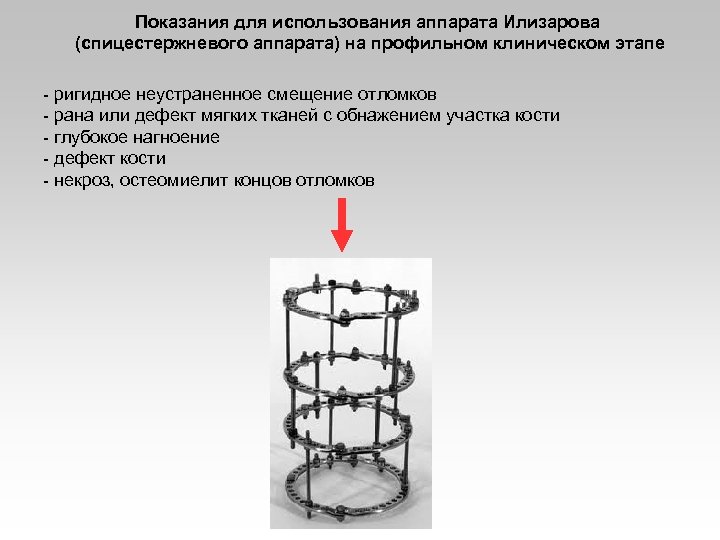 Показания для использования аппарата Илизарова (спицестержневого аппарата) на профильном клиническом этапе - ригидное неустраненное