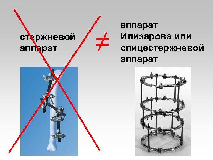 стержневой аппарат ≠ аппарат Илизарова или спицестержневой аппарат 